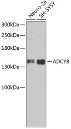 Gastrin-releasing Peptide/Bombesin/Neuromedin C Rabbit anti-Human, Mouse,